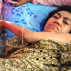 TKW Sumbawa Pulang Lumpuh, Tidak Pernah Digaji 10 Tahun