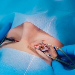 Tim Ekspedisi NKRI Adakan Baksos Operasi Katarak Gratis