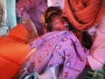 Bayi Kembar Siam Tanpa Pendampingan Pemerintah