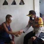 Kapolres Sumbawa Bantu Pengobatan Nurdin Penderita Tumor Mata